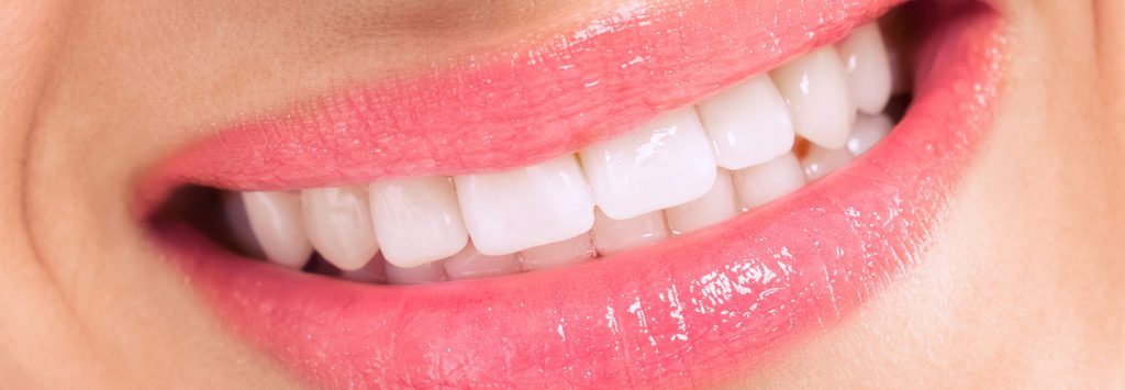 Dental Treatment After - Patient Smile Transformation
