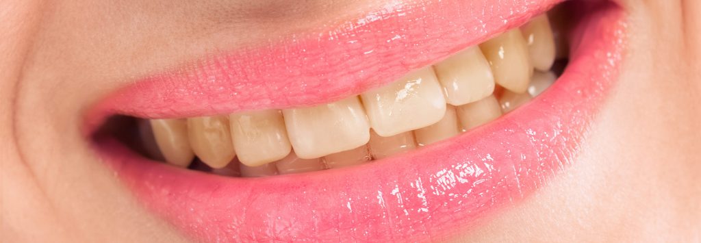 Dental Treatment Before - Patient Smile Transformation