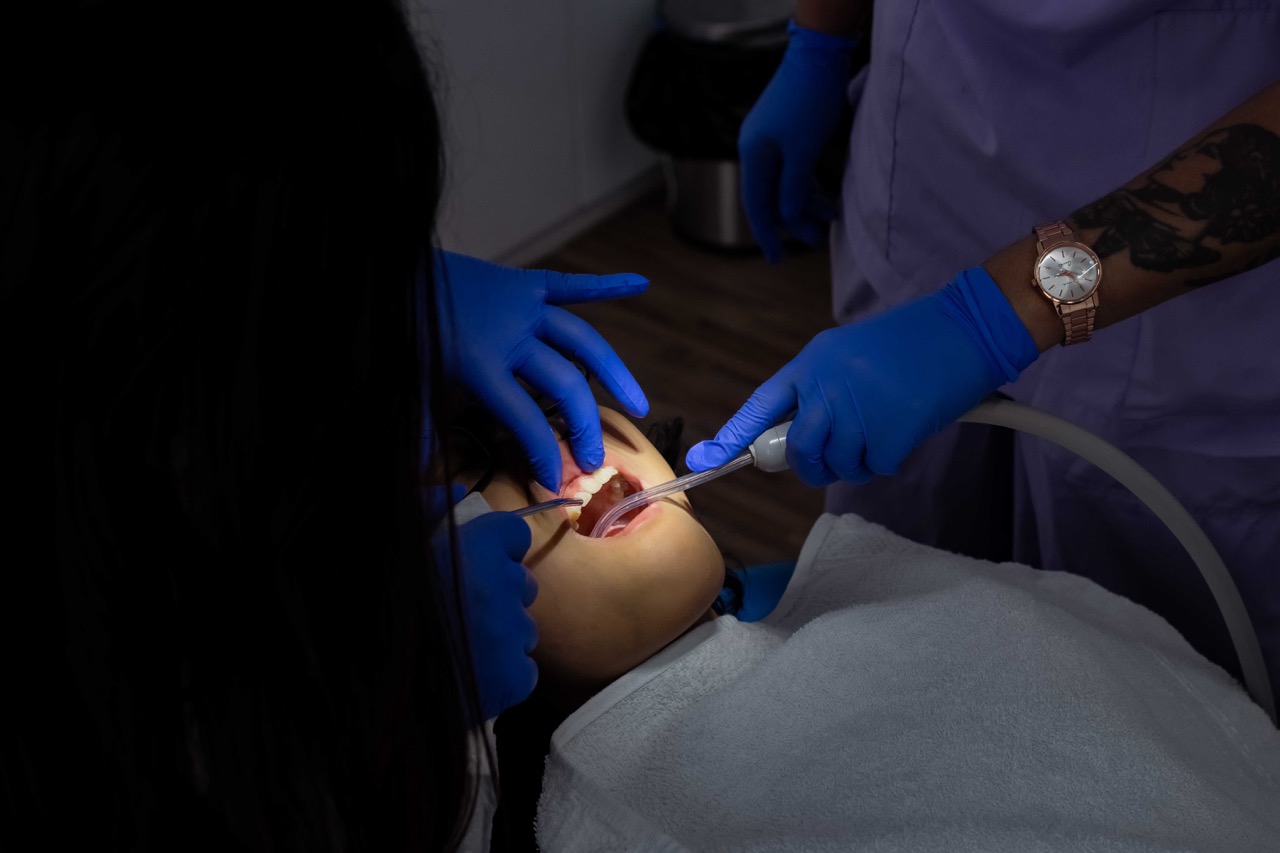 Professional teeth whitening at Aura Dental & Aesthetic Clinic